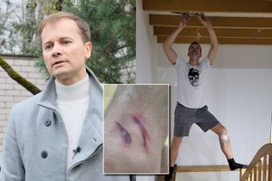 Nerijus Juška tik per plauką išvengė didžiulės nelaimės: gyvenimas prabėgo per kelias sekundes