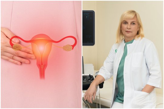Ginekologė kreipėsi į moteris: tai – pagrindinis vėžio „žemiau juosmens“ sukėlėjas