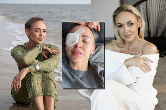 Po rimtos akies operacijos „Man-go“ vokalistė R. Petrauskytė neslėpė šoko: „Katastrofa“
