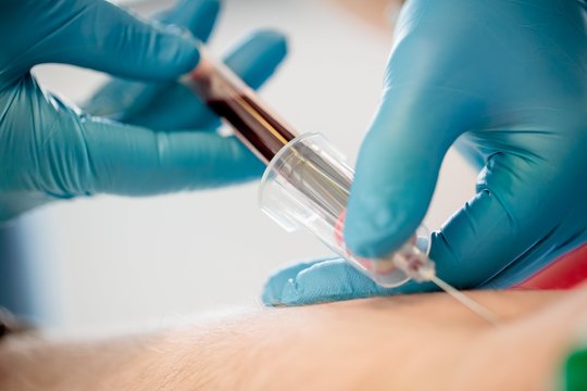 Pavasarinis nuovargis: šeimos gydytojas įvardijo 5 tyrimus, padedančius nustatyti priežastis