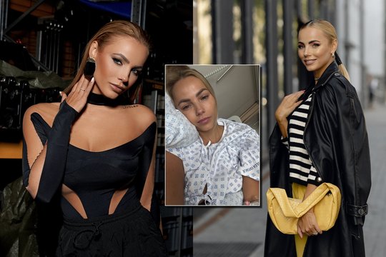 Dainininkei Godai Alijevai atliktos dvi operacijos: „Tiesiog negalėjau rizikuoti“