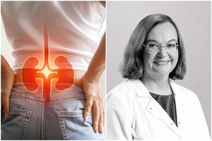 Kol nėra simptomų: gydytoja pasakė, kaip išsiduoda „tylios“ inkstų ligos