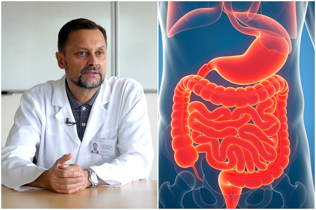 Profesorius apie žarnyno tyrimus už šimtus eurų: „Žmonės tuos pinigus išmeta į šiukšlių dėžę“