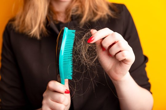 Plaukų slinkimas pavasarį: atskleidė, kada tai – organizmo pagalbos šauksmas