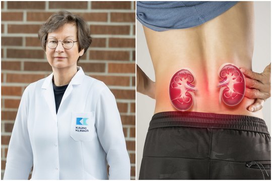 Lėtinė inkstų liga nustatoma per vėlai: išvardijo, kokiems žmonėms būtina pasitikrinti