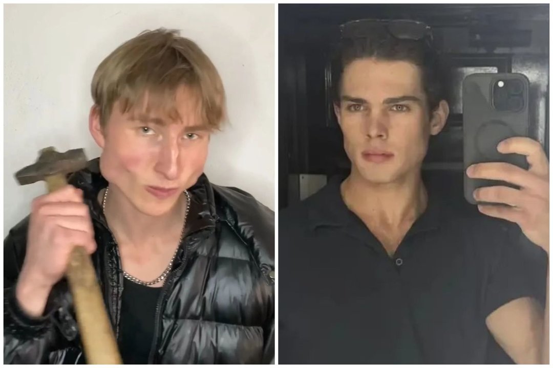 Jaunų vyrų aukos dėl grožio šiurpina: daužo žandikaulį plaktuku, trokšta „medžiotojo akių“