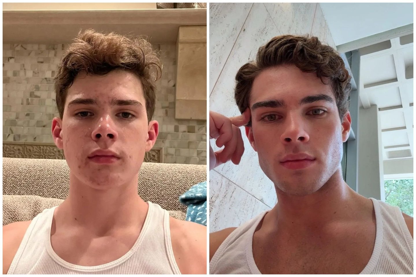 Clavicular dažnai mėgsta lyginti savo išvaizdą „prieš ir po“.<br> Socialinių tinklų nuotr.