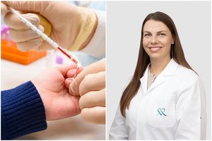 Gydytojos patarimai pagal amžių: 30, 40 ir 50 metų – ką vertėtų išsitirti?