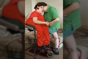 Po 40-ies metų viena iš Siamo dvynių apsiskelbė vyru: nesitikėjo net sesuo