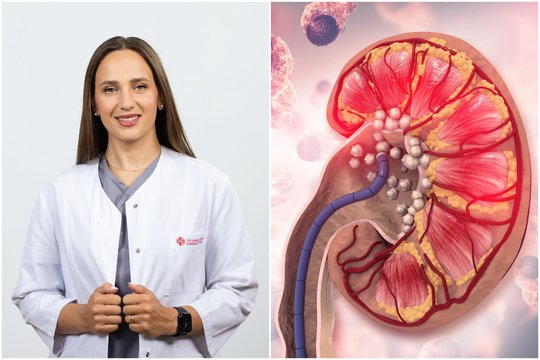 Medikai įspėja: sparčiai daugėja inkstų ligų – daugybė žmonių daro skaudžią klaidą