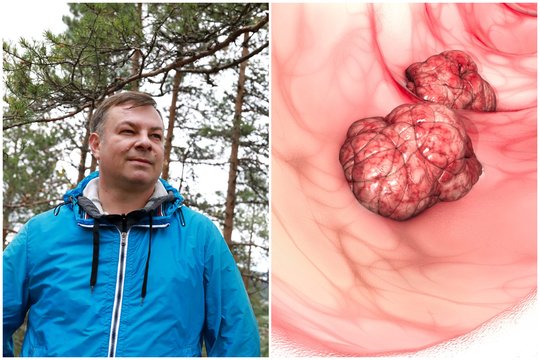 47-erių lietuvis negalėjo patikėti, kad serga vėžiu – ligą išdavė kraujo lašeliai