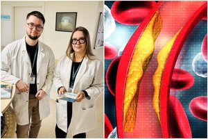 Patarimai, kaip sumažinti cholesterolį ir apsaugoti smegenų kraujotaką: Klaipėdos neurologai parengė mitybos rekomendacijas