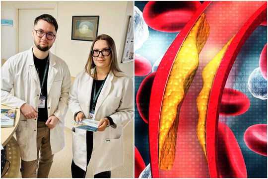 Patarimai, kaip sumažinti cholesterolį ir apsaugoti smegenų kraujotaką: Klaipėdos neurologai parengė mitybos rekomendacijas