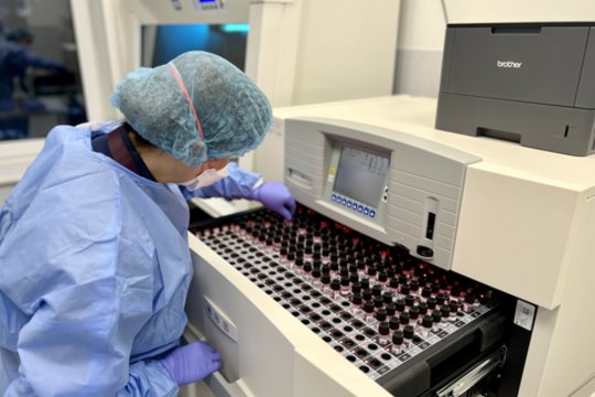 Pernai Lietuvoje diagnozuoti 626 nauji tuberkuliozės atvejai