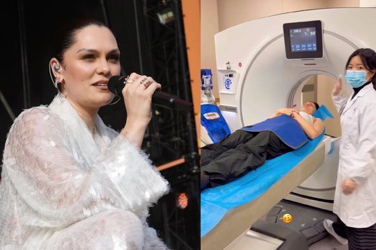Turo metu Jessie J susižalojo galva, dainininkė atsidūrė ligoninėje