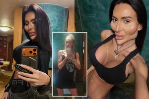 Didžiausių skruostų savininkė parodė, kaip atrodė anksčiau: gerbėjai liko be žado