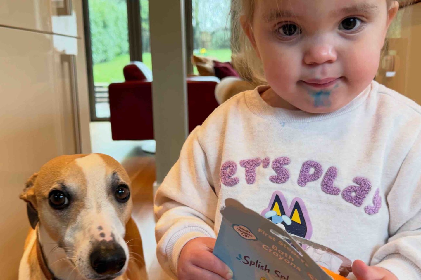 Leni diagnozuotas Sanfilippo sindromas – reta neurodegeneracinė liga, pasitaikanti maždaug vienam iš 70 000 naujagimių.<br> GoFundMe nuotr.