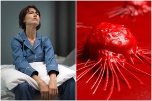 Įsidėmėkite: apie vėžio pradžią įspėja du organizmo signalai 
