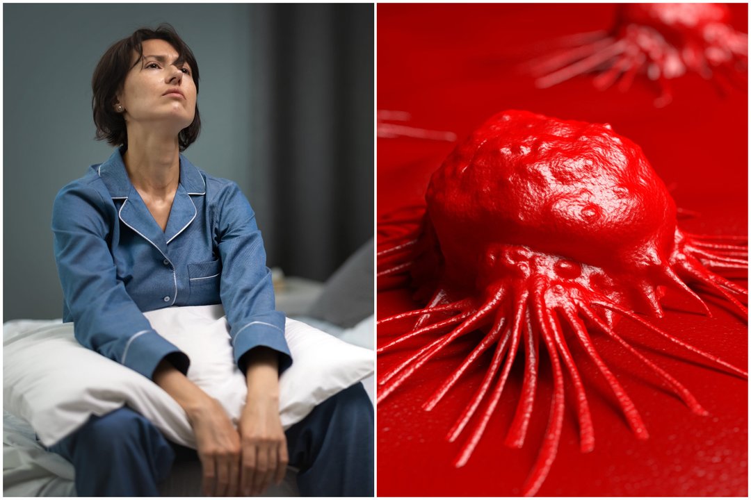 Įsidėmėkite: apie vėžio pradžią įspėja du organizmo signalai 