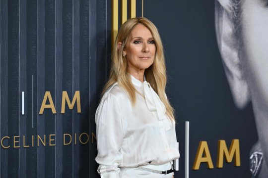 Retos ligos kankinama Celine Dion pranešė neįtikėtiną žinią
