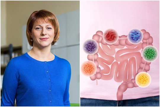Fermentai ir probiotikai: vaistininkė paaiškino, kuo jie skiriasi