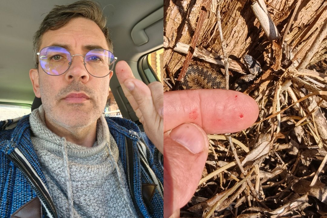 Gamtininkui Mariui Čepulis įkando angis: pranešė apie simptomus