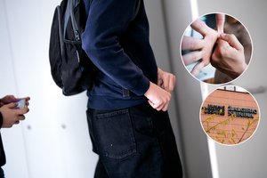 Šokiruojanti autizmą turinčio penktoko istorija: kelis kartus dūrė peiliu ir sulaužė žandikaulį, bet kaltų nėra