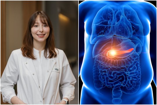 Prieš Velykas – gydytojos įspėjimas: nedarykite šios klaidos, kitaip išsivystys kasos uždegimas