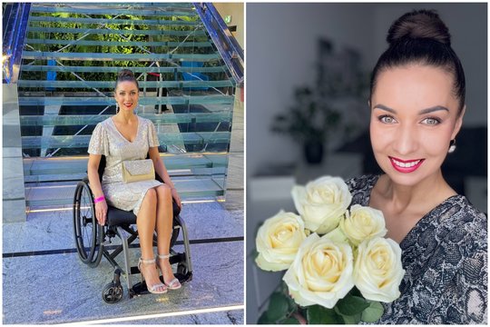 Nuolatinius skausmus kenčianti grožio specialistė Jurgita: „Kartais net skauda prausiantis po dušu“