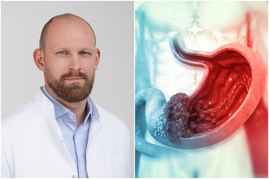 Gydytojas prašo suklusti: skrandžio vėžys – klastinga liga, kurią išduoda keli simptomai