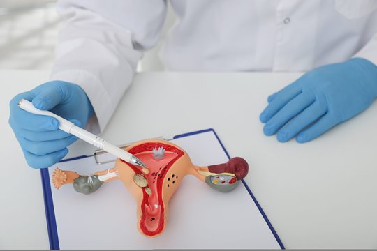 Papasakojo apie gimdos miomų gydymą: ką svarbu žinoti pacientėms?