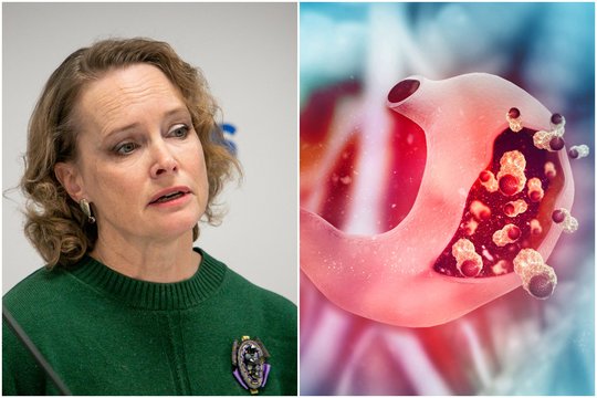 Skrandžio signalai, kuriuos daugelis ignoruoja: gydytoja įspėja – jeigu delsia, išsivysto vėžys