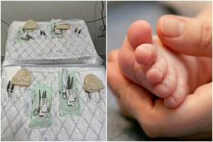 Ligoninėje – reta šventė: šeima sulaukė ketvertuko