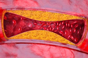 Kardiologas įvardijo geriausius pusryčius: „sugaudo“ cholesterolį ir mažina cukraus kiekį kraujyje