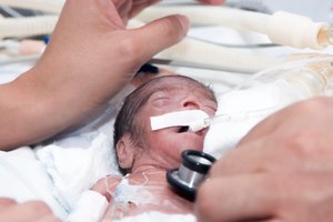 Gimė vos 400 gramų svorio: medikai šios mergaitės istoriją vadina stebuklu