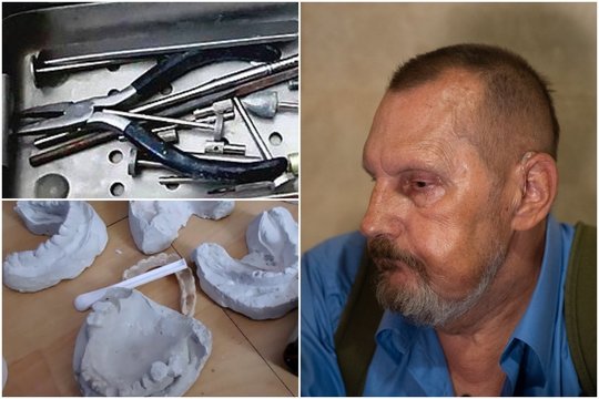 „Neskęstantis“ apsišaukėlis: staliaus įrankiais pacientų dantis rakinėjęs Kauno „odontologas“ vėl išvengė kalėjimo