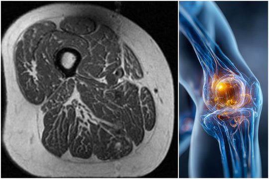 Tyrimo nuotrauka pribloškė medikus: vaizdas priminė kai ką skaudžiai pažįstamo