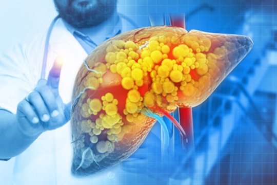 Išmokite kaip maldą: 10 geriausių produktų kepenims atstatyti