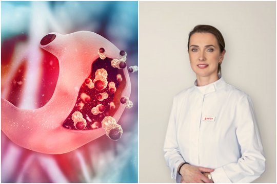 Jei jaučiate nuovargį, gydytoja įspėja – mažakraujystę sukelia ir skrandžio bakterija