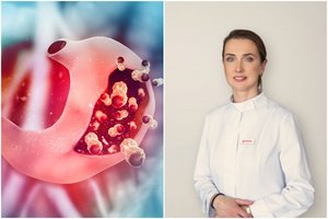 Jei jaučiate nuovargį, gydytoja įspėja – mažakraujystę sukelia ir skrandžio bakterija