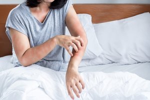 Su persodintu inkstu gyvenanti moteris perspėja: apie klastingą ligą gali išduoti ir odos niežėjimas