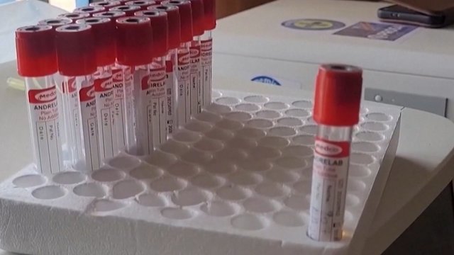 Aptikta nauja Ebolos viruso atmaina: PSO perspėja dėl tarptautinės grėsmės