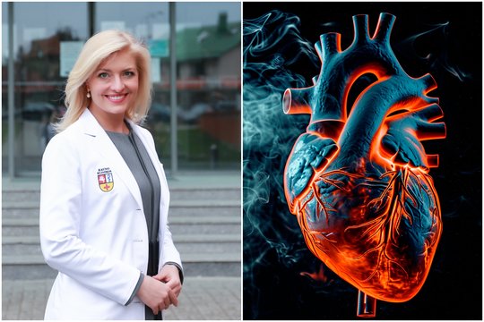Širdies ir kraujagyslių ligos jaunėja: kardiologė paaiškino, ką su tuo turi bendro nutukimas