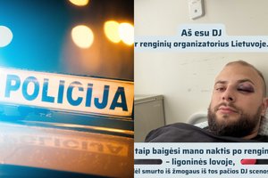 Vilniuje užpultas ir sumuštas žinomas didžėjus: vakaras baigėsi ligoninėje