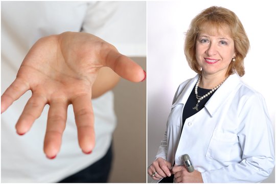 Nutirpo ranka? Neurologė įspėja – gali būti klastingos ligos požymis