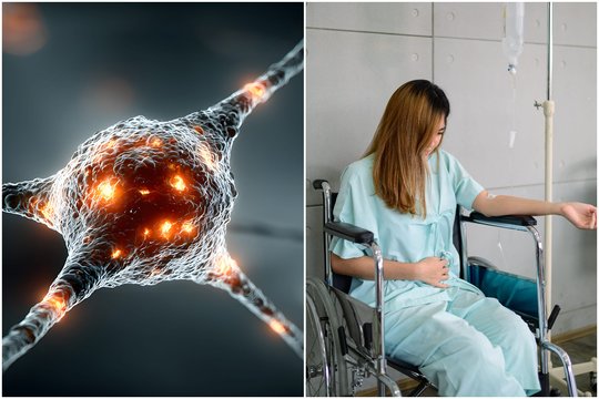 Neurologė prašo įsidėmėti išsėtinės sklerozės požymius: šie ženklai negali praslysti pro akis