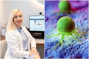 Šis vėžys – „didysis apsimetėlis“: gydytoja paatviravo, kokią apsaugą naudoja kasdien