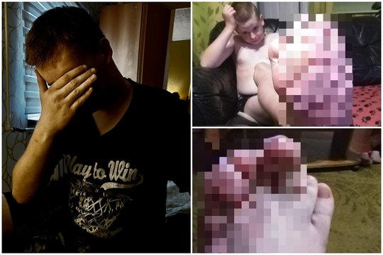 Kūną deformuojančios ligos išdarkytas Rimantas jau bijo parodyti veidą: peržengus lemtingą ribą mama maldauja tik vieno