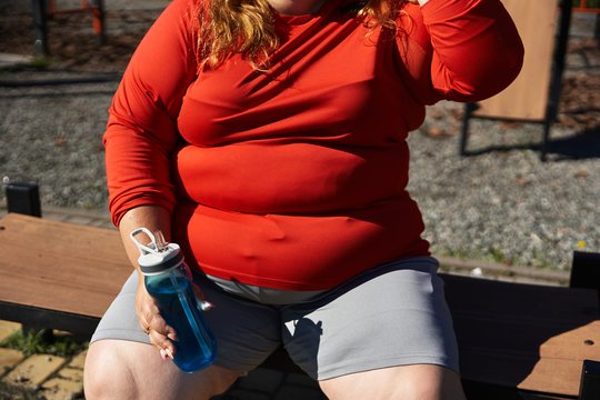 Chirurgas apie plastines operacijas: ką moterys nutyli apie pilvo ir krūtinės plastiką