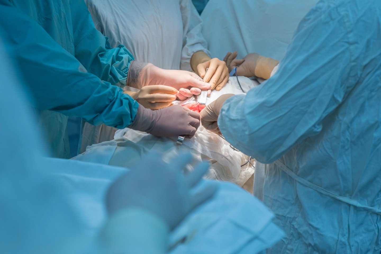 Chirurginė operacija<br>Asociatyvi 123rf nuotr.